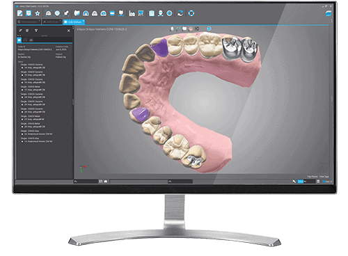 Sự bùng nổ của Thiết kế Nha khoa 3D: Một bước ngoặt cho Phòng thí nghiệm Nha khoa Hiện đại