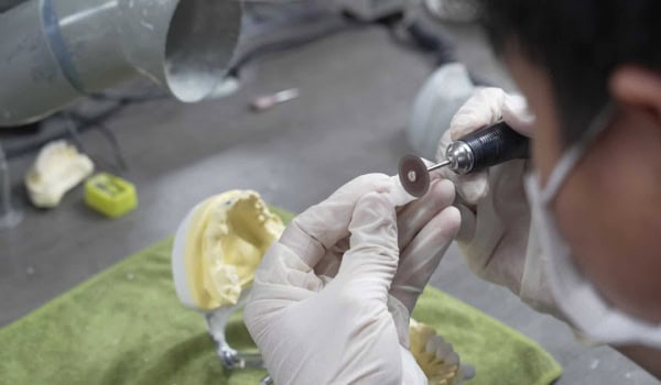 dental lab advice dental clinics should focus on patients’ emotions in denture treatment