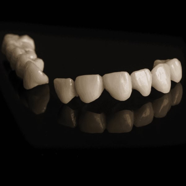 Dental Lab Outsourcing presents high-quality zirconia restoration