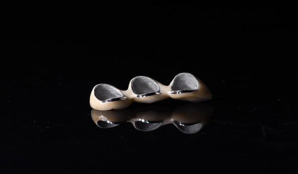 Dental Lab Outsourcing: Choosing the Right Material for Your Restorations – Zirconia vs. Metal