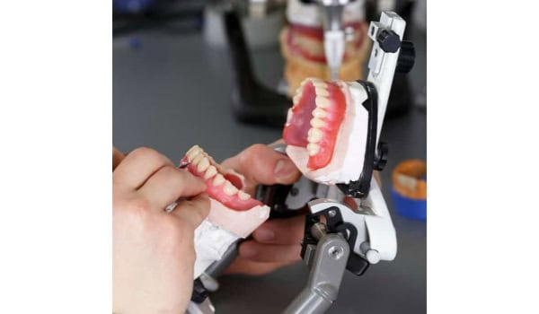 Local Dental Lab: Attract More Patients With Dental Lab Services