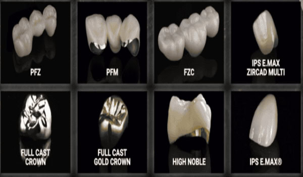 DENTAL CROWNS & BRIDGES