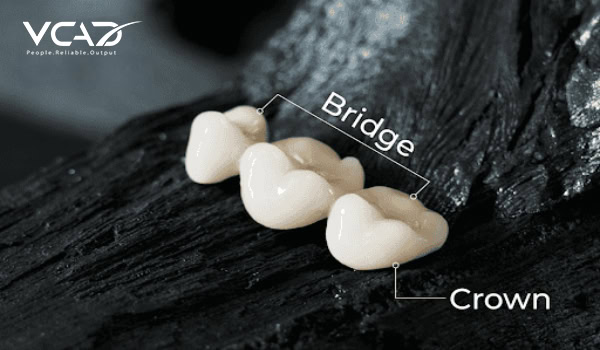 DENTAL CROWNS & BRIDGES