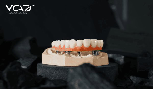 Dental Implant